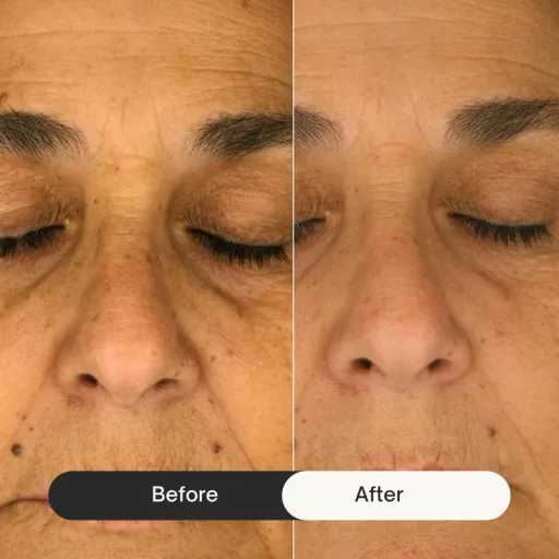 Cremă pentru ochi Farma Dorsch împotriva cearcănelor, ridurilor și a pungilor.