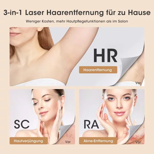 LUBEX IPL Szőrtelenítő Készülék Hűtéssel, 999.900 Impulzus, 3in1 Funkció