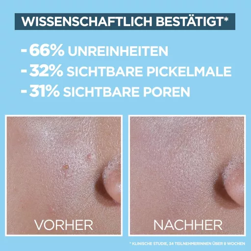 Garnier Invisible Matt SPF 50+ Napvédő Fluid Akné és Pattanások Ellen 40ml