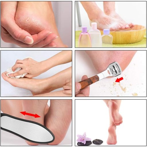 KLADNDER Körömcsipesz Szett Rozsdamentes Acél Pedikűr Körömvágó Lábápolás