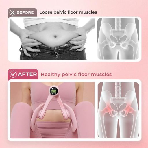 Sunshine smile Comb Trainer Intelligens Számlálóval Csípő és Lábedzéshez